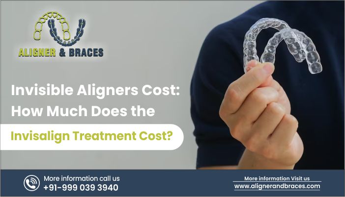 Invisible Aligners Cost: How Much Does the Invisalign Treatment Cost?