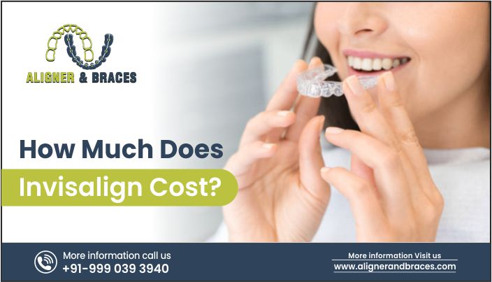 How Much Does Invisalign Cost?-Informative Guide