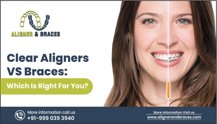 Clear Aligners VS Braces: Which Is Right For You?