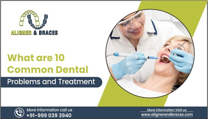 What Are 10 Common Dental Problems And Treatment