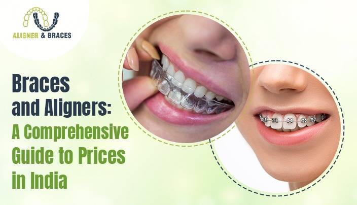 Braces And Aligners: A Comprehensive Guide To Prices In India