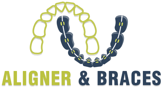 Aligners & Braces Logo