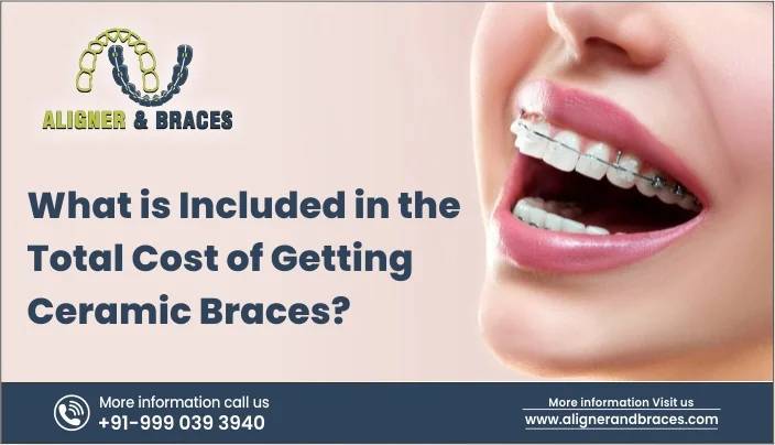 What Is Included In The Total Cost Of Getting Ceramic Braces?