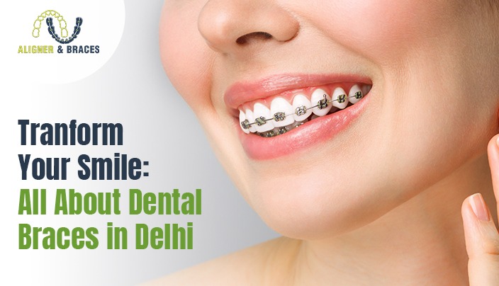 Transform Your Smile: All About Dental Braces in Delhi